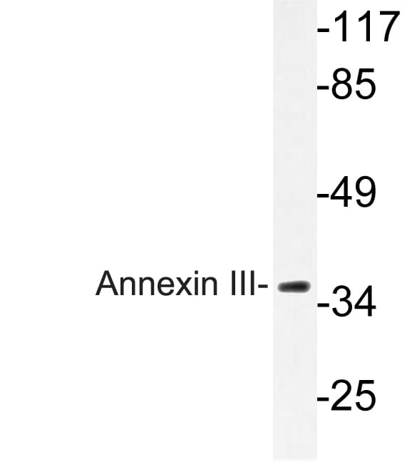 ANXA3 / Annexin A3 Antibody (Tyr64)