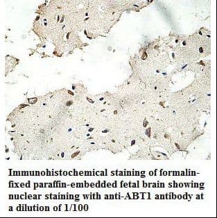 Polyclonal Rabbit anti-Human HABT1 / ABT1 Antibody (aa2-272, IHC, WB)
