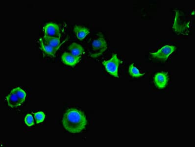 IHC-plus™ SGCA / DAG2 Antibody
