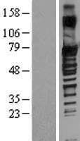 SOX13 Protein (Over-Expression Lysate Myc-DDK (Flag))