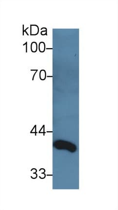 DLK1 / Pref-1 Antibody (aa81-311)