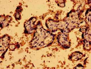 P2RY1 / P2Y1 Antibody