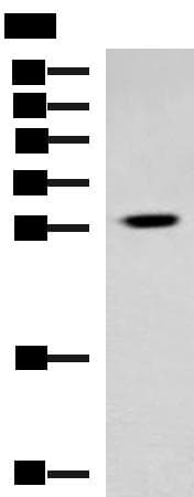 Polyclonal Rabbit anti-Human TBCB / CKAP1 Antibody (IHC, WB)