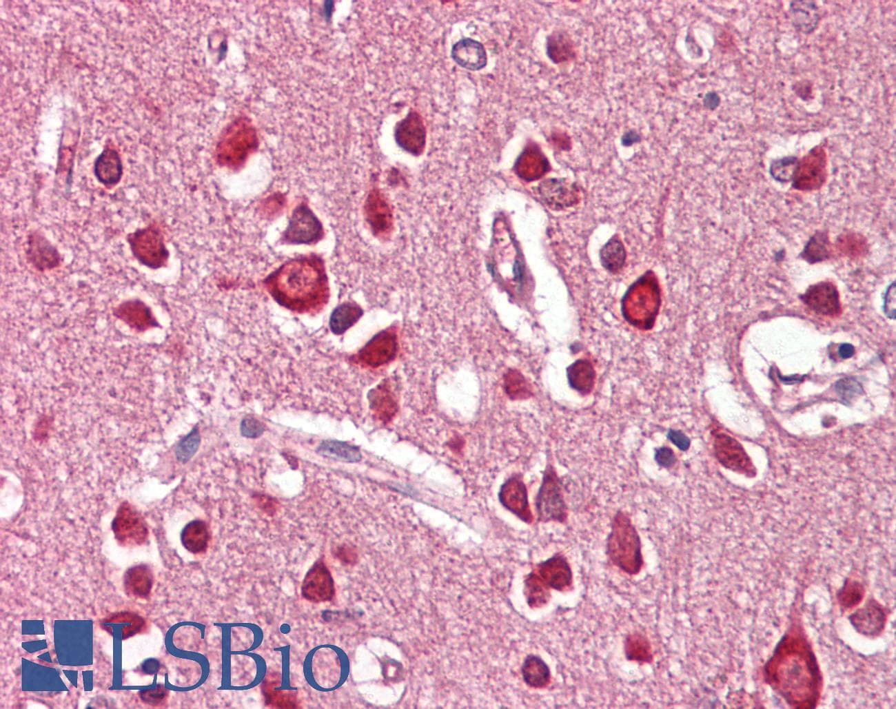 IHC-plus™ Polyclonal Goat anti-Human UNC5H3 / UNC5C Antibody (aa812-823, IHC, IF)