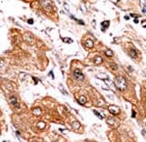 Polyclonal Rabbit anti-Human BIK Antibody (phospho-Thr33, IHC, WB)