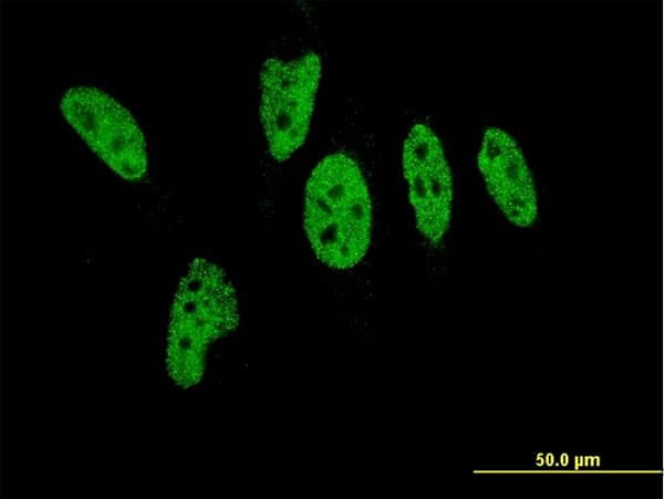 IHC-plus™ EP300 / p300 Antibody (clone 1B1)