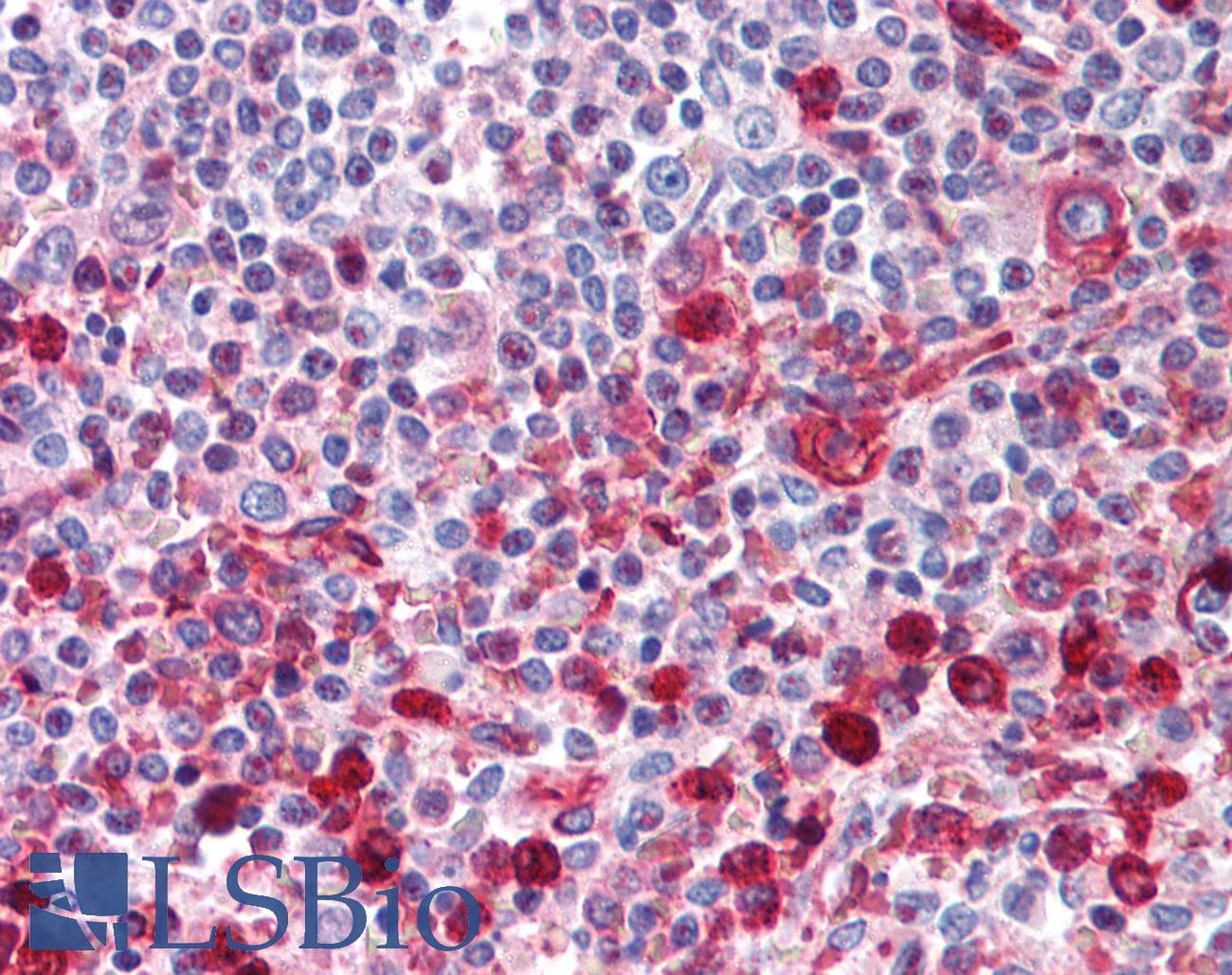 IHC-plus™ WNT16 Antibody (Internal)