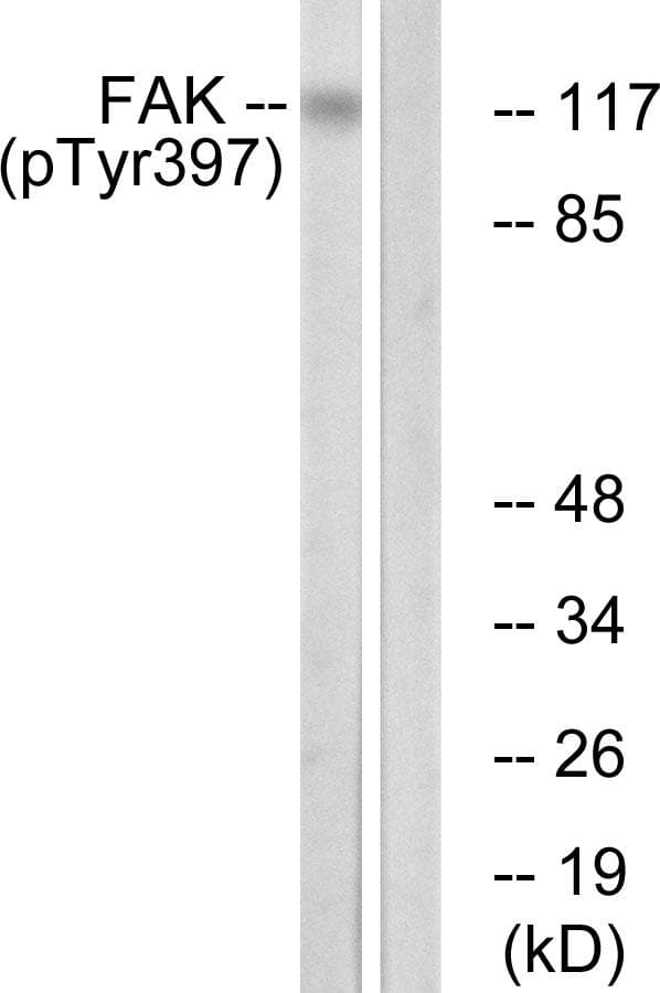 FAK / Focal Adhesion Kinase Antibody (phospho-Tyr397)