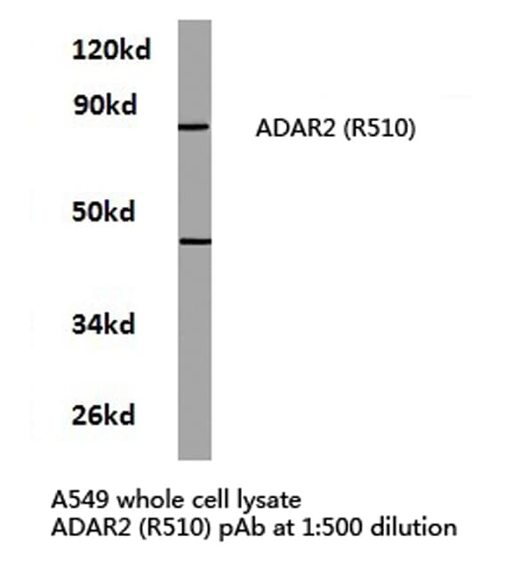 ADAR2 / ADARB1 Antibody (Arg510)