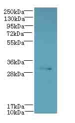 Polyclonal Rabbit anti-Human CYB5R2 Antibody (IHC, WB)