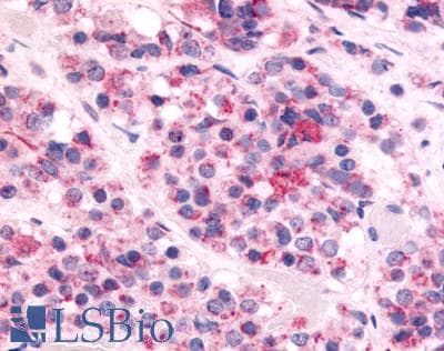 IHC-plus™ OX1R / Orexin Receptor 1 Antibody (C-Terminus)