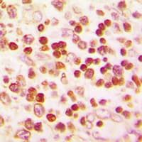 Polyclonal Rabbit anti-Human PAX1 Antibody (Internal, IHC, WB)