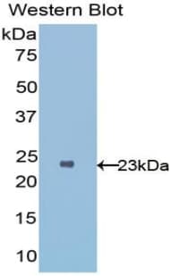 IL1RL1 Antibody (aa162-349)