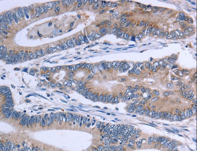 Polyclonal Rabbit anti-Human SLC1A6 / EAAT4 Antibody (IHC, WB)