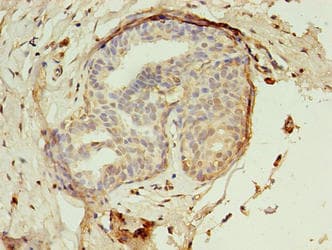 EBP Antibody (aa2-230)