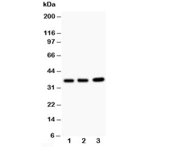 Polyclonal Rabbit anti-Human TNFAIP1 Antibody (aa27-52, IHC, WB)