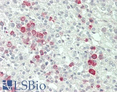 IHC-plus™ MAPK7 / ERK5 Antibody
