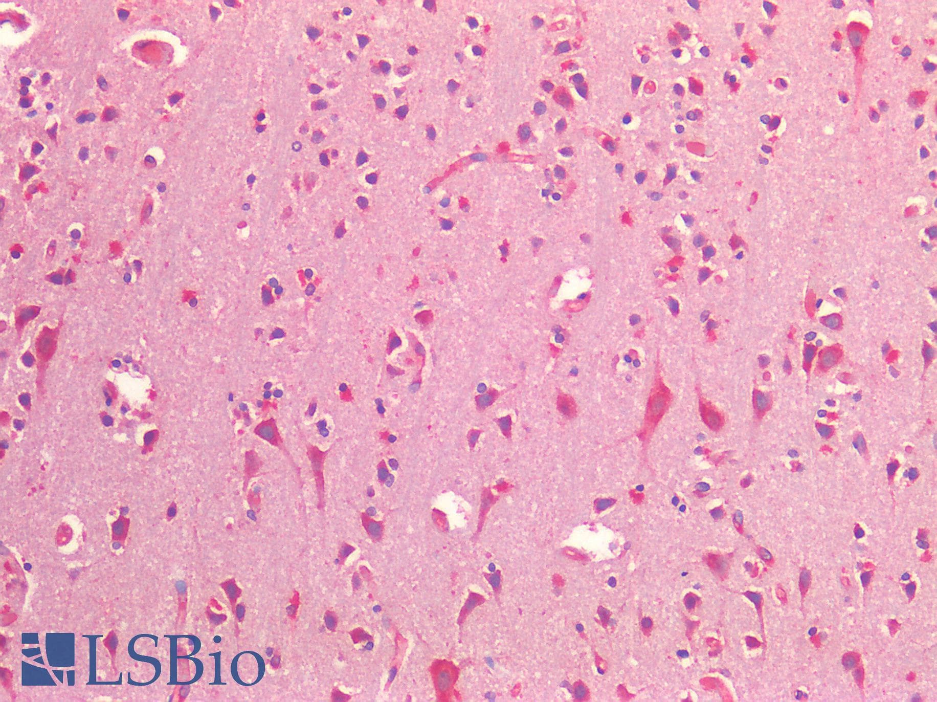 IHC-plus™ NRN1 / Neuritin Antibody