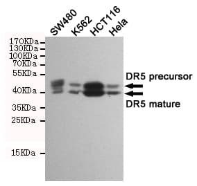 Monoclonal Mouse anti-Human TNFRSF10B / Killer / DR5 Antibody (WB)