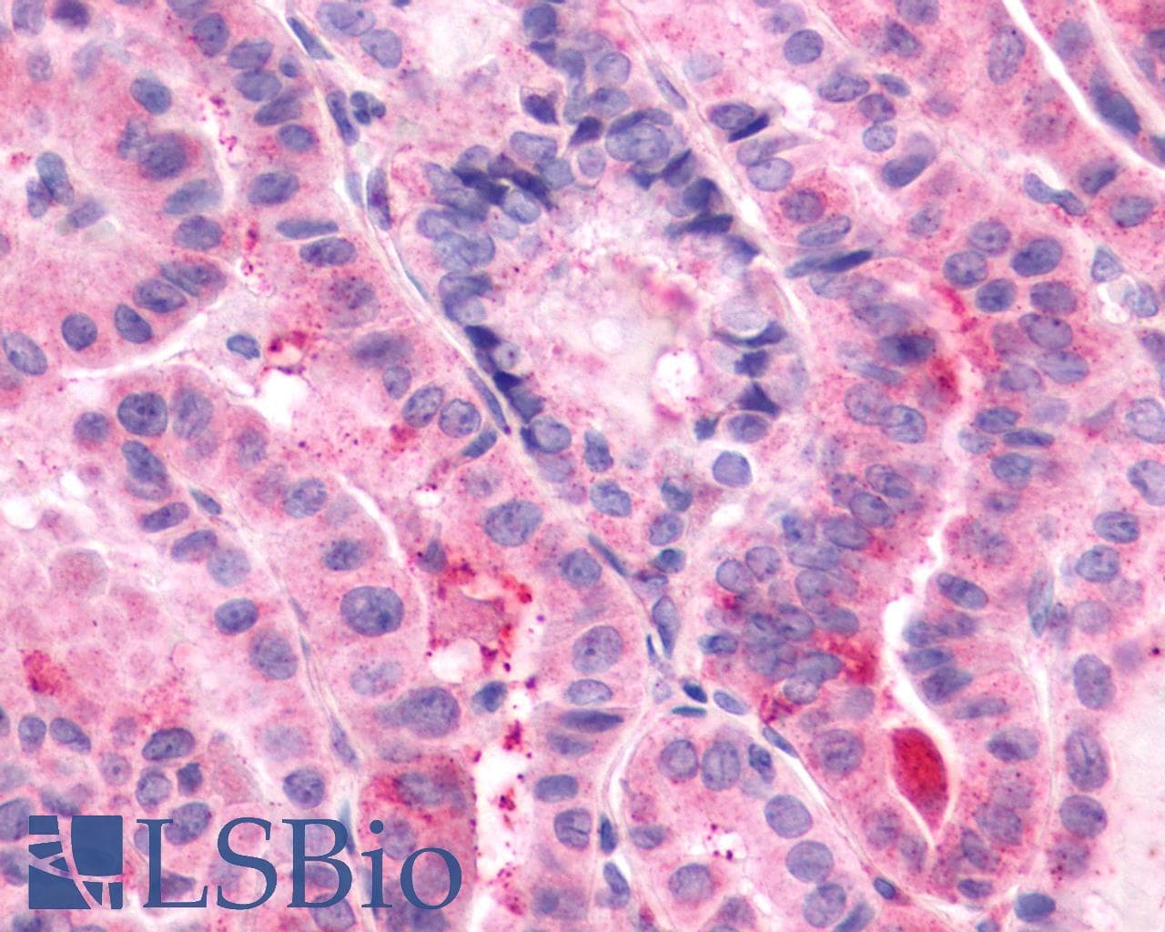PathPlus™ ADGRE5 / CD97 Antibody (N-Terminus)