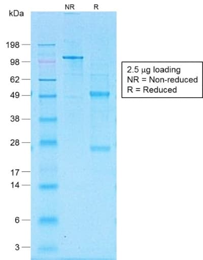 CD30 Antibody (clone Ki-1/1505R, Azide-free, Carrier-free)