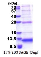Human C5orf13 Protein (Recombinant His)