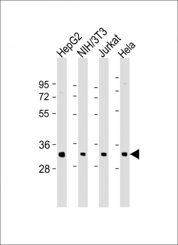 RPS2 / Ribosomal Protein S2 Antibody (N-Terminus)