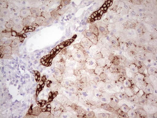 ABCB1 / MDR1 / P Glycoprotein Antibody (aa995-1280, clone OTI1A7, Carrier-free)