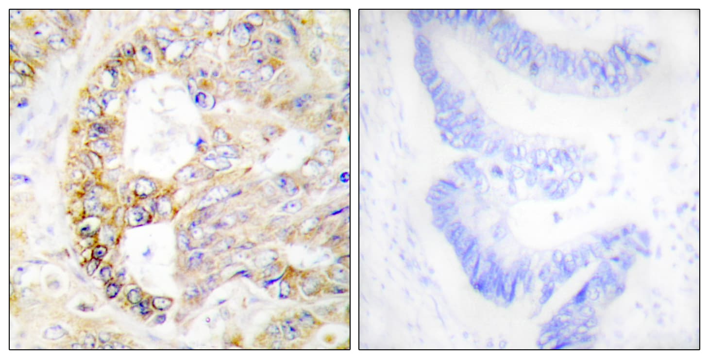Polyclonal Rabbit anti-Human COXIV / COX4 Antibody (aa11-60, IHC, WB)