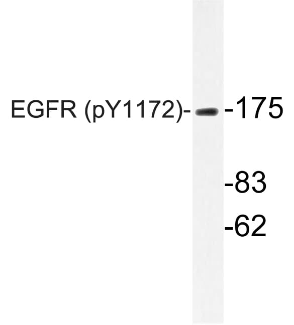 EGFR Antibody (phospho-Tyr1172)