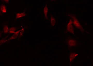 NDUFA8 Antibody