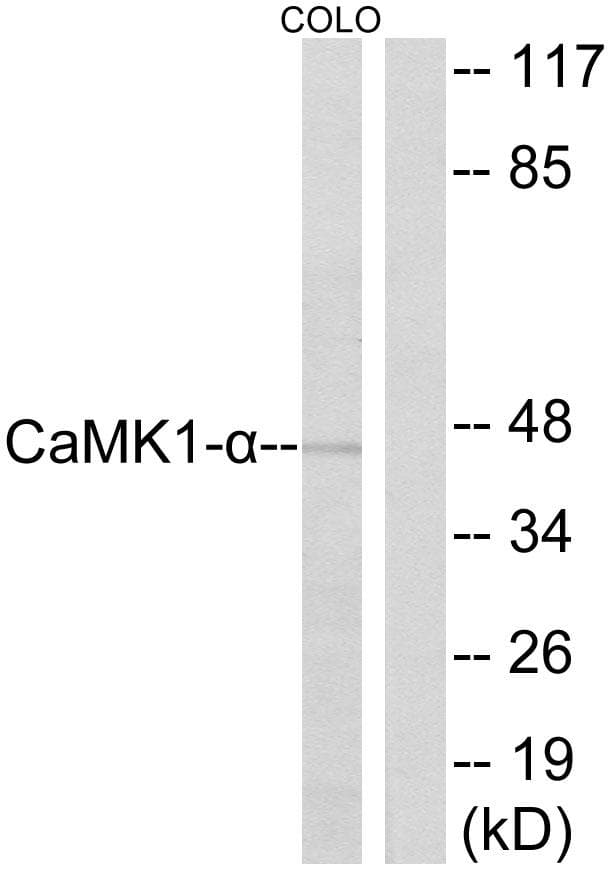 Polyclonal Rabbit anti-Human CAMK1 / CAMKI Antibody (p177, IHC, WB)