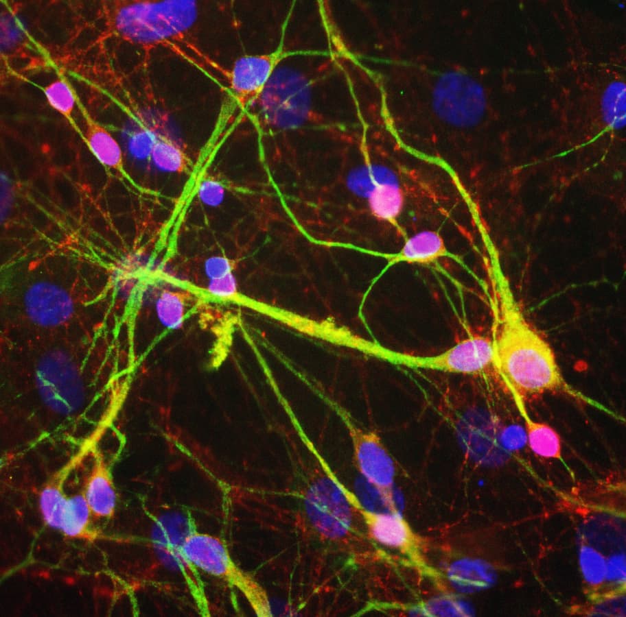 SNCA / Alpha-Synuclein Antibody