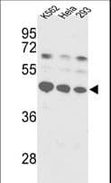 PathPlus™ Polyclonal Rabbit anti-Human SSB / La Antibody (aa366-397, IHC, WB)