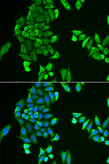 Polyclonal Rabbit anti-Human ACSS2 / ACAS2 Antibody (IHC, IF, WB)