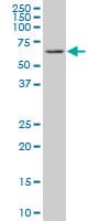 Monoclonal Mouse anti-Human RICK / RIP2 Antibody (clone 3D9, WB)