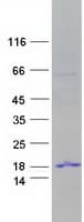 Human TP53TG3 Protein (Recombinant Myc-DDK (Flag))