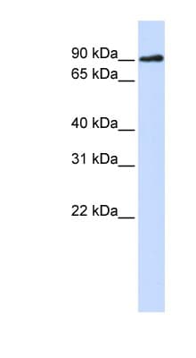 DCLRE1C / Artemis Antibody (N-Terminus)