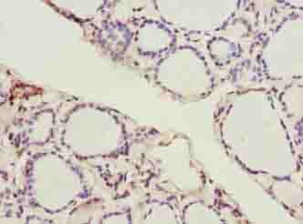 Polyclonal Rabbit anti-Human SLC52A1 / GPR172B / PAR2 Antibody (IHC)