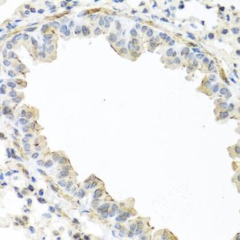 IL22 Antibody