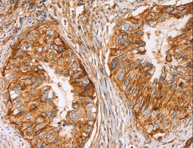 Polyclonal Rabbit anti-Human CD59 Antibody (IHC, WB)