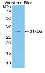 HAVCR1 / KIM-1 Antibody (aa22-237)