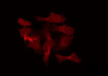 RAB40B Antibody