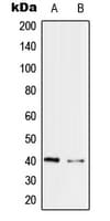 PRPF18 Antibody (Internal)