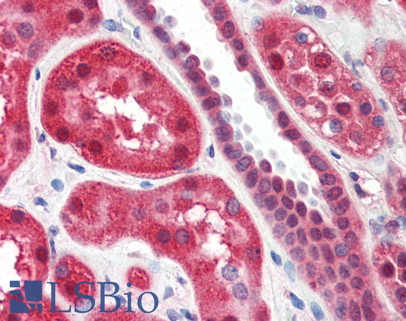 IHC-plus™ ALOX15 / 15-Lipoxygenase Antibody (aa482-494)