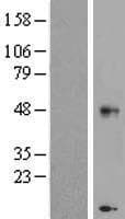 Human CHST11 Protein (Over-Expression Lysate Myc-DDK (Flag))