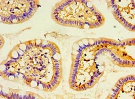 ENTPD5 / CD39L4 Antibody (aa149-428)