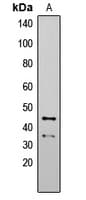 Polyclonal Rabbit anti-Human APG4B / ATG4B Antibody (Internal, IHC, WB)