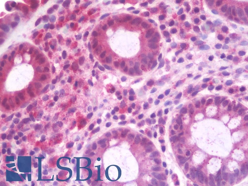IHC-plus™ RABEP2 Antibody (aa353-402)