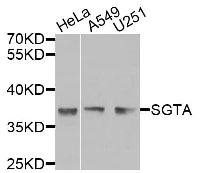 SGTA / SGT Antibody